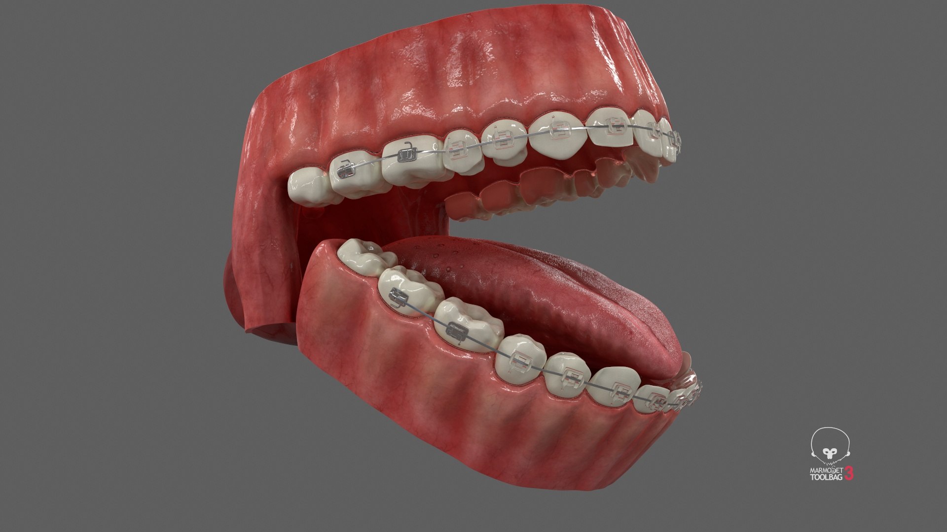 Human Mouth With Transparent Dental Braces V04 3D model https://p.turbosquid.com/ts-thumb/Lo/ypf9UY/eF/screenshot004/jpg/1711971851/1920x1080/fit_q87/1ed41d33e56e5acf566d35f585e8981861318827/screenshot004.jpg