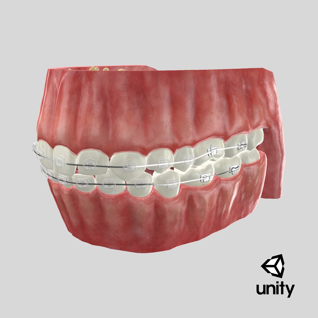 Human Mouth With Transparent Dental Braces V04 3D model https://p.turbosquid.com/ts-thumb/Lo/ypf9UY/hl/stemcell_unity_render/png/1712696971/1920x1080/fit_q87/075cbdaaa70ff5ca381d4d8c3271c2e78d541481/stemcell_unity_render.jpg