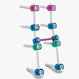 Lumbar Cervical Spine Fixation System Colored