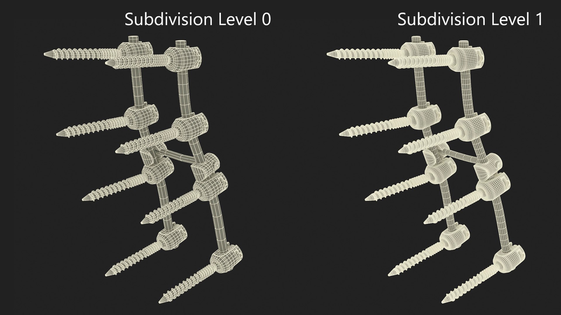 Lumbar Cervical Spine Fixation System Colored 3D model https://p.turbosquid.com/ts-thumb/M2/GZ5x1O/E2/lumbarcervicalspinefixationsystemcoloredvray3dmodel016/jpg/1710685385/1920x1080/fit_q87/1f01606f329fff530520a23e173aac61cb7ae0fa/lumbarcervicalspinefixationsystemcoloredvray3dmodel016.jpg