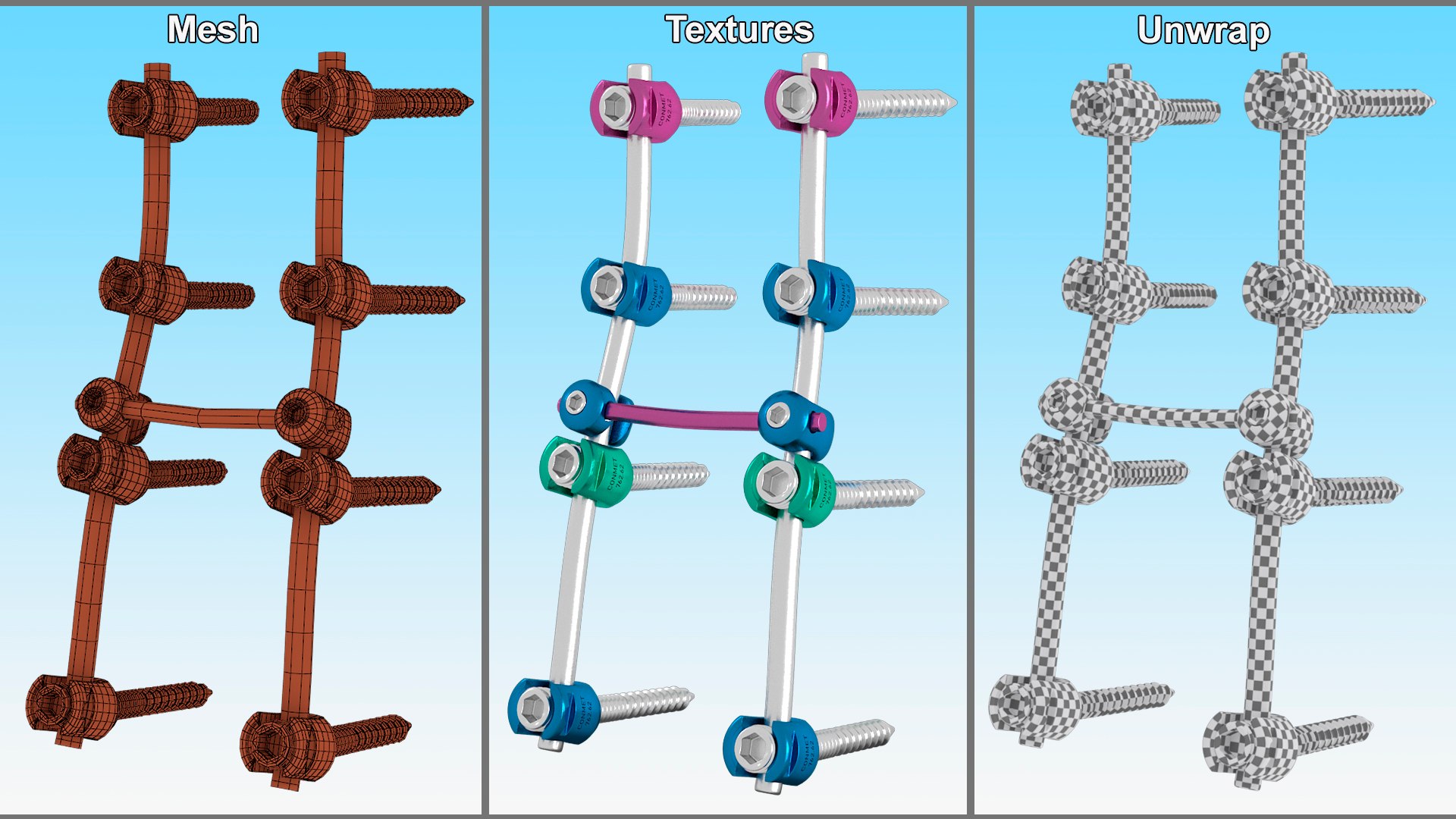 Lumbar Cervical Spine Fixation System Colored 3D model https://p.turbosquid.com/ts-thumb/M2/GZ5x1O/oc/lumbarcervicalspinefixationsystemcoloredvray3dmodel015/jpg/1710685382/1920x1080/fit_q87/be749ec4ac4e874c40fd5c5f0583865078bb459f/lumbarcervicalspinefixationsystemcoloredvray3dmodel015.jpg