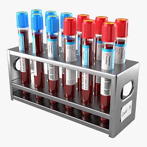 Test Tubes with Stand