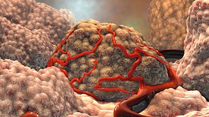cancer tumor cells 3D