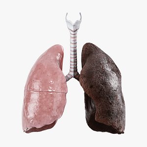 3D Human Lungs Healthy and Damaged Collection