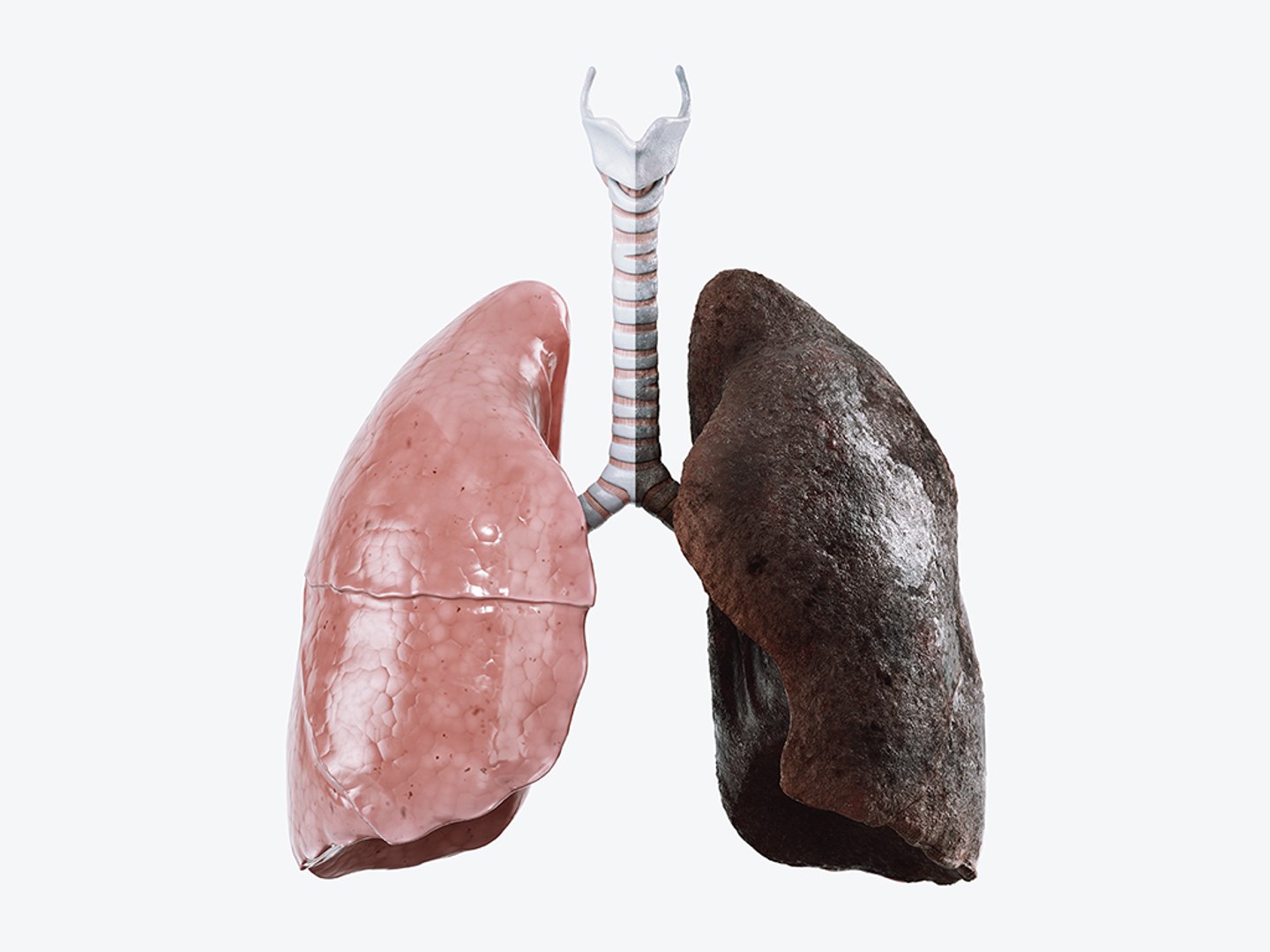 3D Human Lungs Healthy And Damaged Collection - TurboSquid 1915603