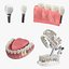 tooth implants 3D model