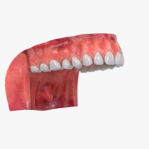 Human upper jaw with Teeth