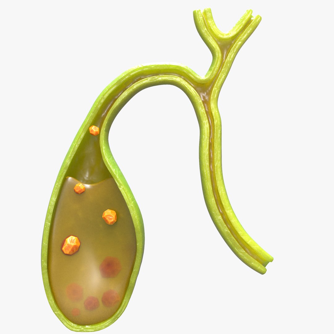 Gallbladder With Gallstones Model - TurboSquid 1842451