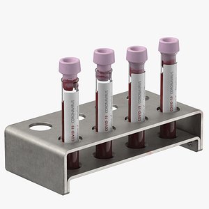 Coronavirus Blood Samples 02 Positive