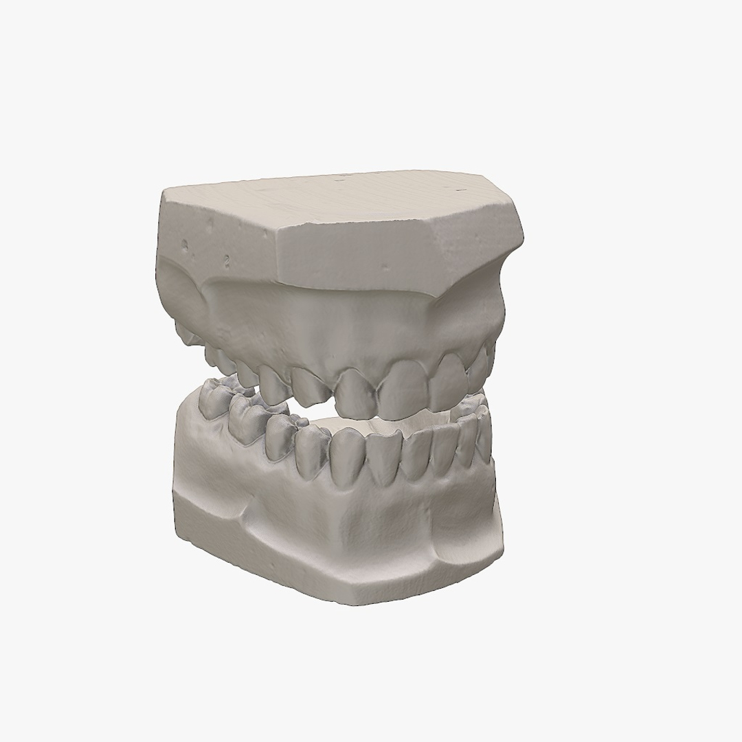 gypsum teeth 3d max https://p.turbosquid.com/ts-thumb/Mh/osCpUC/A228xuo6/turntable/jpg/1401794275/1920x1080/turn_fit_q99/dcd9a096c2227aaf2ec2650281219cf368a9fa94/turntable-1.jpg