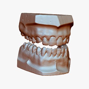 gypsum teeth 3d max