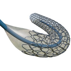 Medical Stent