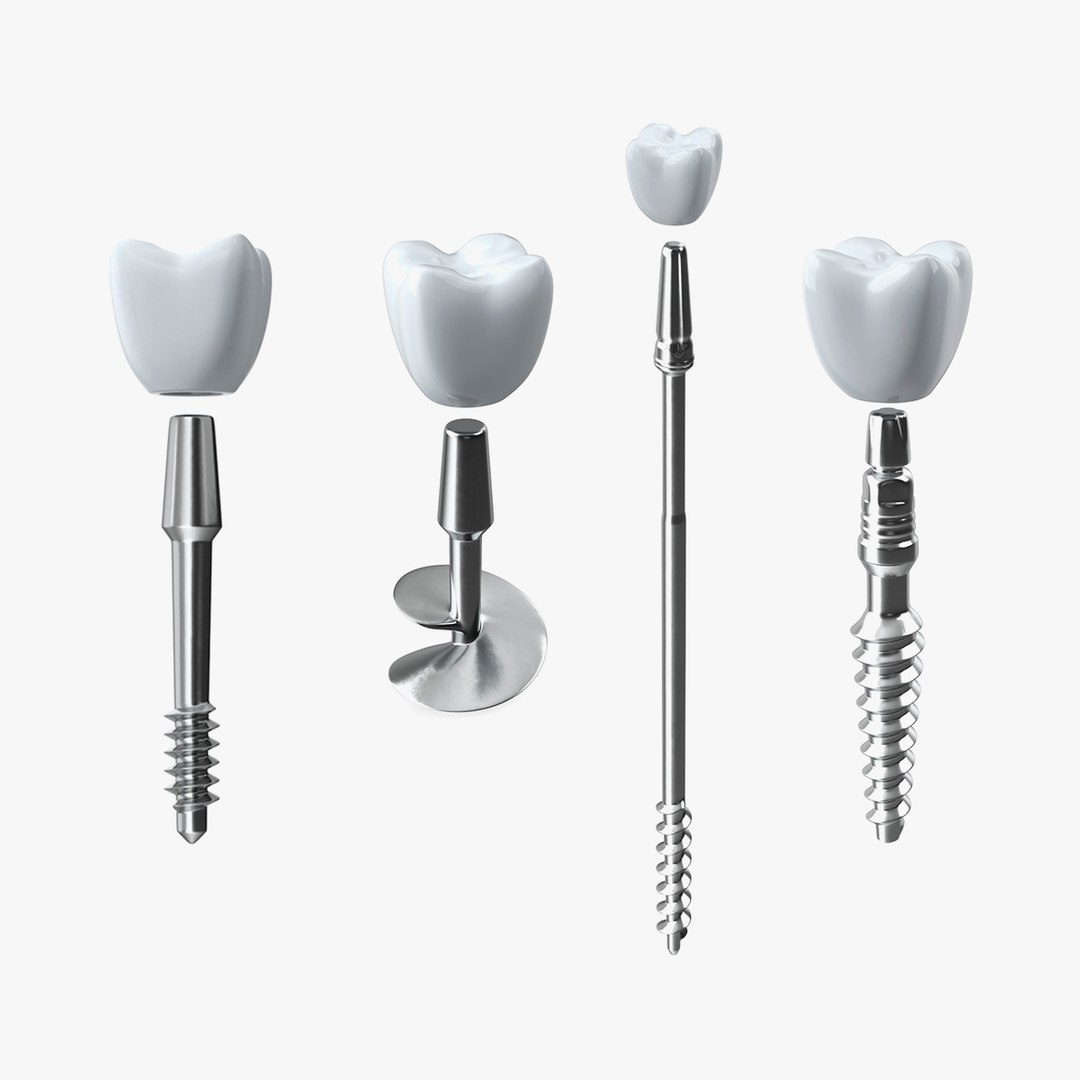 Dental Implants Collection 2 3D model preview