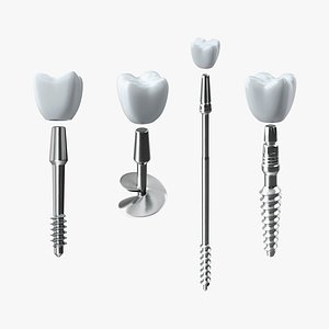 Dental Implants Collection 2