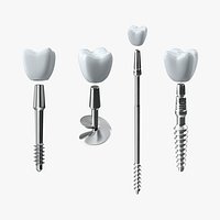 Dental Implants Collection 2
