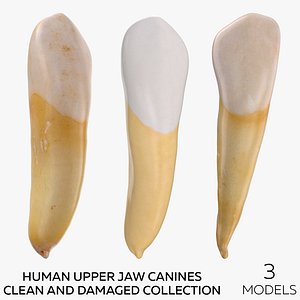 3D Human Upper Jaw Canines Clean and Damaged Collection - 3 models model