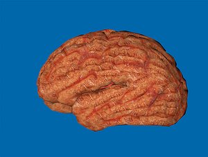 3d model brain