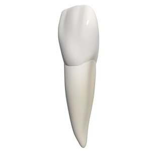 3d lateral incisor