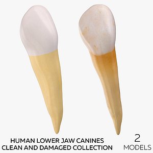 Human Lower Jaw Canines  Clean and Damaged Collection - 2 models 3D model