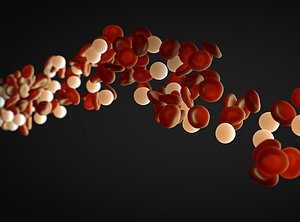 3D leg prosthetic model