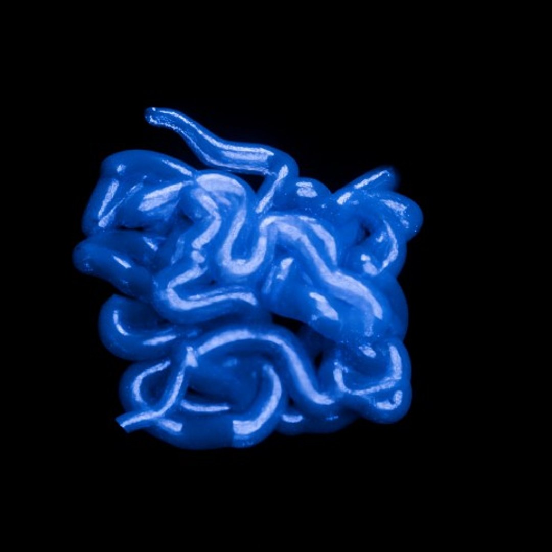 3D Organ with Cancer https://p.turbosquid.com/ts-thumb/Nv/xzPm2l/23/012/jpg/1773569977/1920x1080/fit_q87/45b5829b4a142f0db18b4984493fe0174e3ee53b/012.jpg