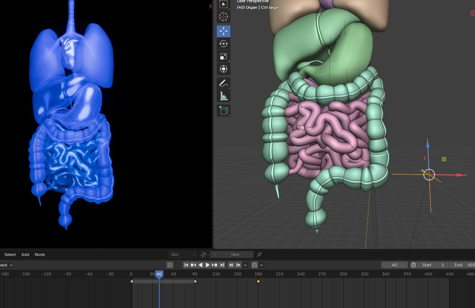 3D Organ with Cancer https://p.turbosquid.com/ts-thumb/Nv/xzPm2l/4J/008/jpg/1773569975/1920x1080/fit_q87/1551a8cedb91125cd75c4349992c6069415b6b8e/008.jpg
