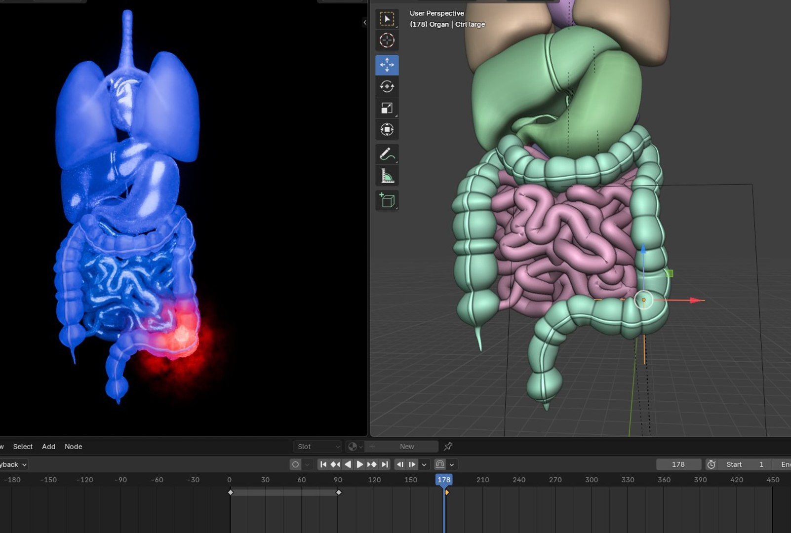 3D Organ with Cancer https://p.turbosquid.com/ts-thumb/Nv/xzPm2l/DG/009/jpg/1773569975/1920x1080/fit_q87/a3ff3a13b865f0004c314bb44dcec4aac23239e5/009.jpg