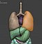 Organ with Cancer