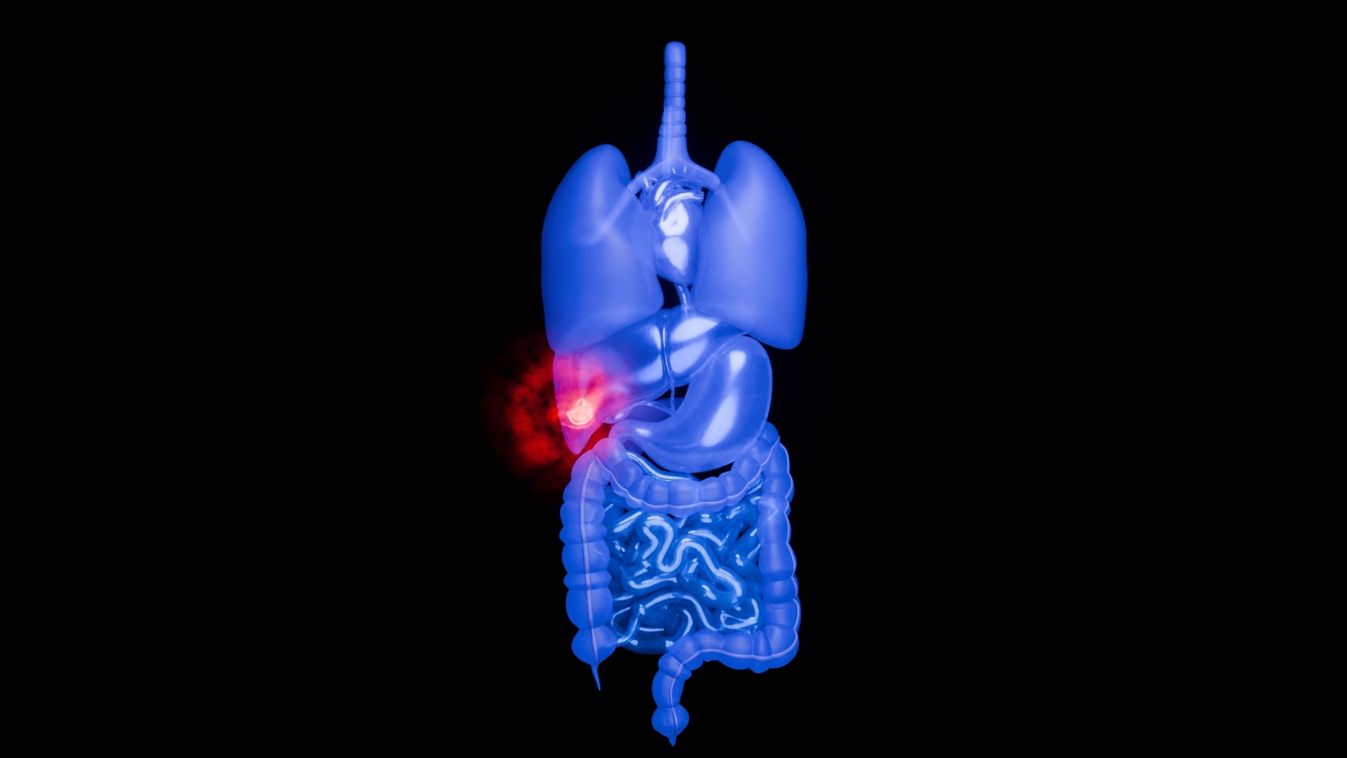 3D Organ with Cancer https://p.turbosquid.com/ts-thumb/Nv/xzPm2l/LM/0041/jpg/1773569838/1920x1080/fit_q87/84c7dd7d3259181109ff846fe7ab675b652a8fd8/0041.jpg