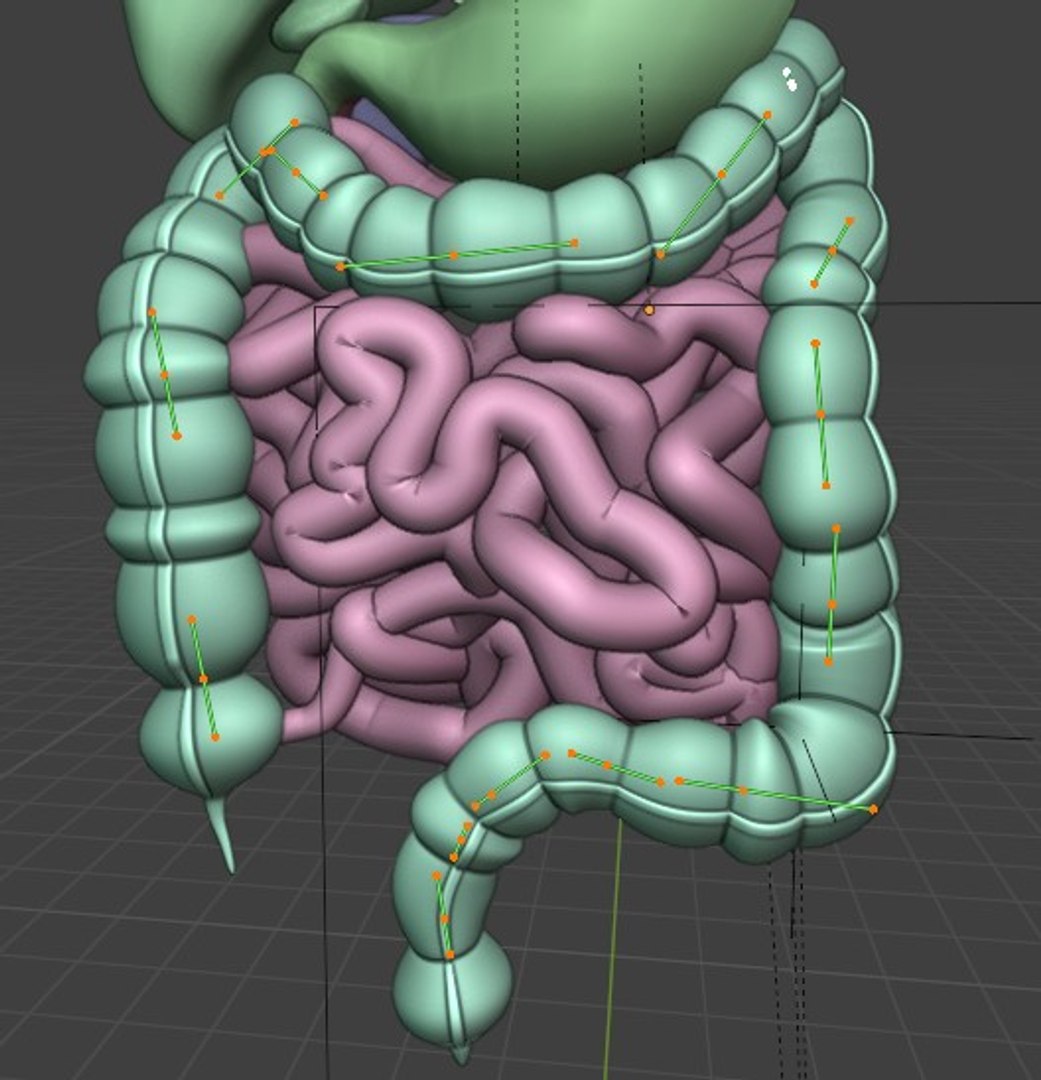 3D Organ with Cancer https://p.turbosquid.com/ts-thumb/Nv/xzPm2l/RD/006/jpg/1773569974/1920x1080/fit_q87/2137eb0c50ef872cd4bd9bd380f985164e561e8a/006.jpg