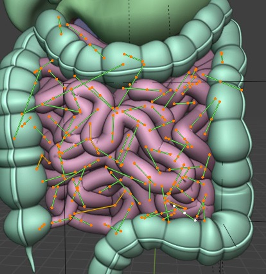 3D Organ with Cancer https://p.turbosquid.com/ts-thumb/Nv/xzPm2l/dj/007/jpg/1773569975/1920x1080/fit_q87/bfb43218c9b69254cbf0476eeca9c7146d4ab12a/007.jpg