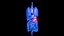 Organ with Cancer