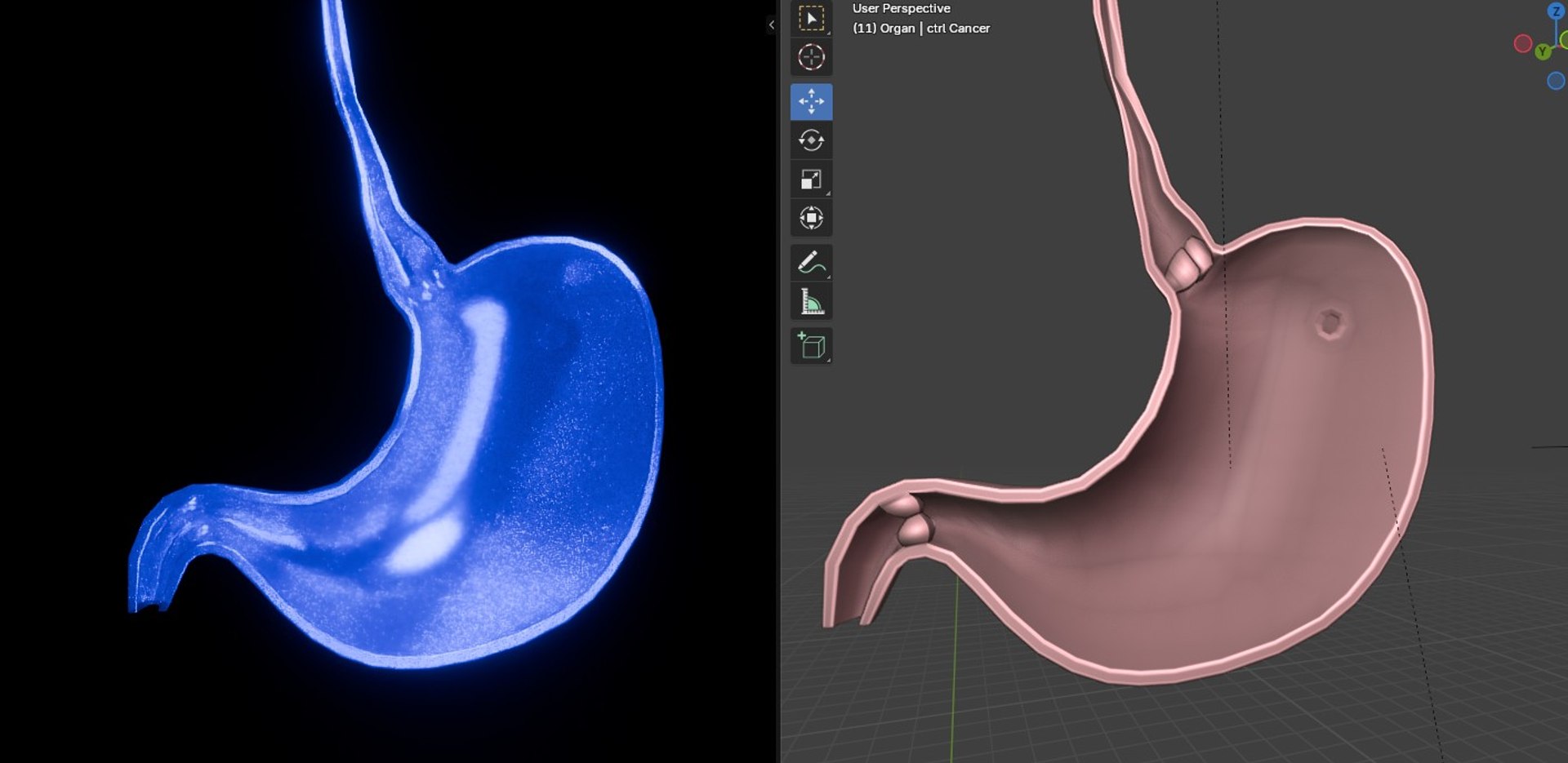 3D Organ with Cancer https://p.turbosquid.com/ts-thumb/Nv/xzPm2l/wF/016/jpg/1773569979/1920x1080/fit_q87/fd385dd4297642a6ba74191dd0265ebf42c20e84/016.jpg