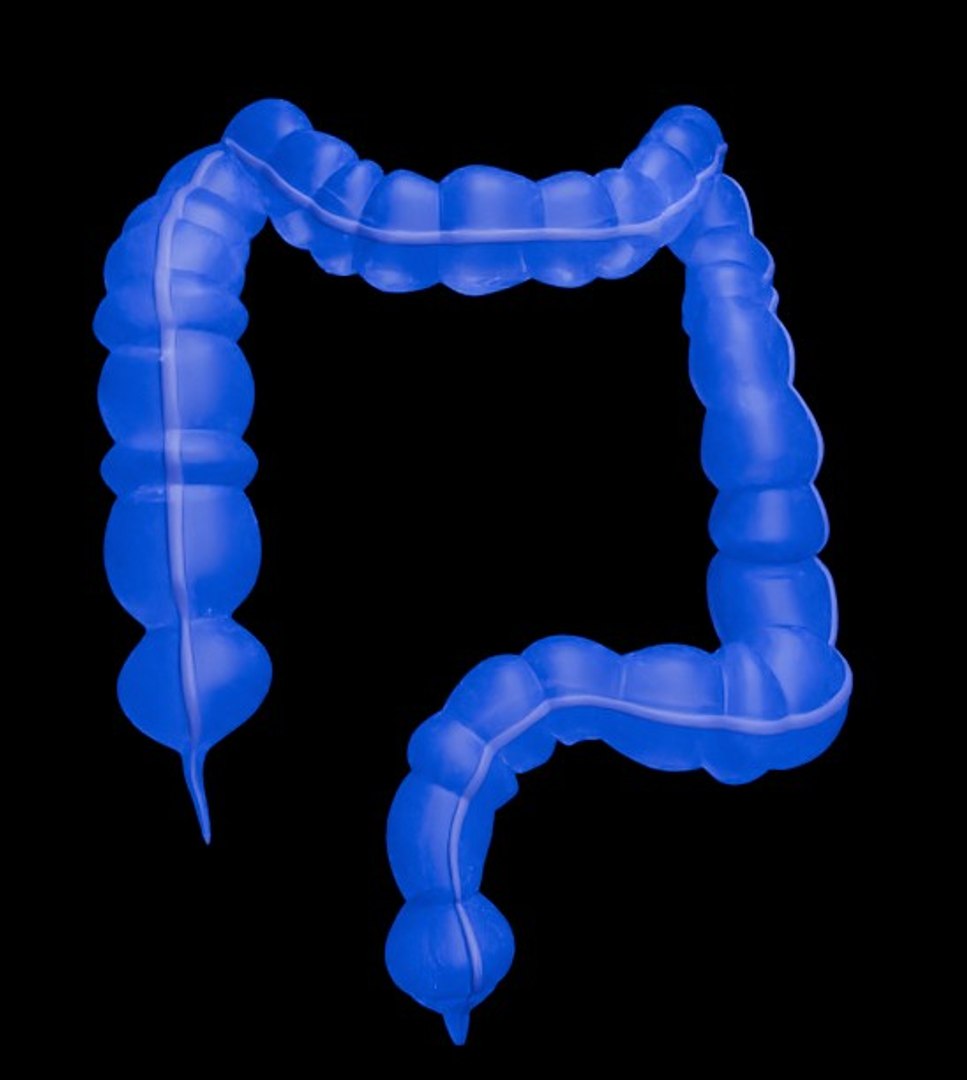 3D Organ with Cancer https://p.turbosquid.com/ts-thumb/Nv/xzPm2l/yt/011/jpg/1773569977/1920x1080/fit_q87/5997b8beae43e2bf40f39520974d68658dc2647a/011.jpg