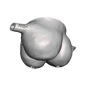 aortic valve model