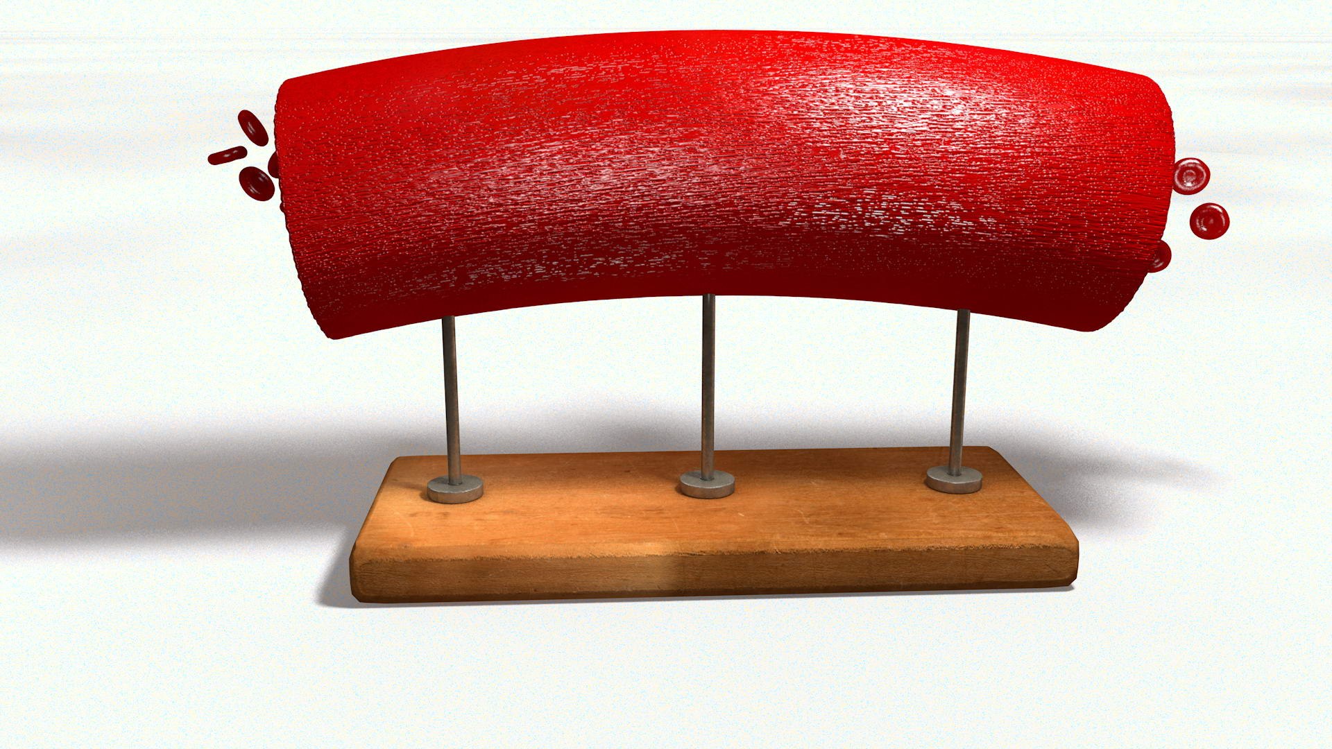 3D sclerotic plaque vessel model https://p.turbosquid.com/ts-thumb/OB/hTv0gm/1jRV1ycX/sclervesselturn010035/jpg/1507156942/1920x1080/fit_q87/b52a417136912690594cba8f10ddb187097e11d7/sclervesselturn010035.jpg