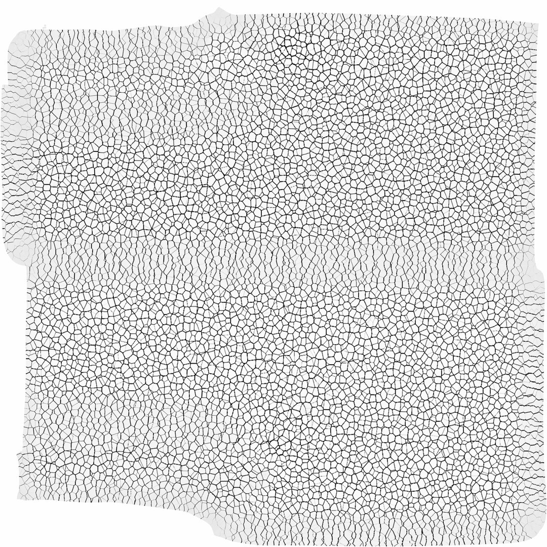 3D sclerotic plaque vessel model https://p.turbosquid.com/ts-thumb/OB/hTv0gm/6pPolUWs/endothelcave/jpg/1507183666/1920x1080/fit_q87/97523b74bd189aea2688cdd7342666a44eea09d4/endothelcave.jpg