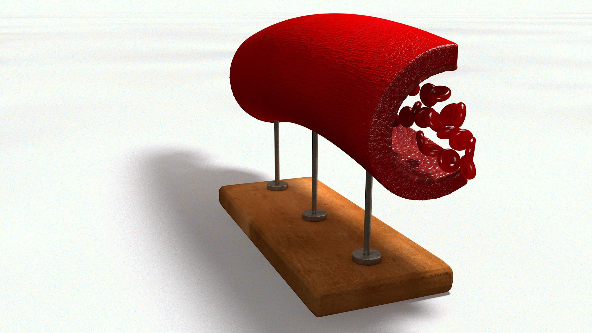 3D sclerotic plaque vessel model https://p.turbosquid.com/ts-thumb/OB/hTv0gm/MdB113rr/sclervesselturn010021/jpg/1507156942/1920x1080/fit_q87/6b63e0da4ca7f9e017876e4650ce322b03d1c424/sclervesselturn010021.jpg