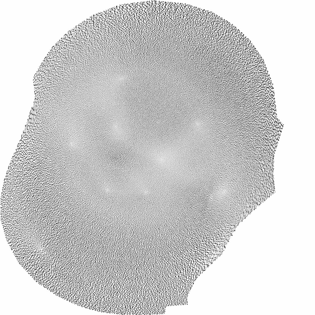 3D sclerotic plaque vessel model https://p.turbosquid.com/ts-thumb/OB/hTv0gm/RqdokNqC/erythocytecave/jpg/1507183666/1920x1080/fit_q87/0efee793754c8a6f6448c122c8f6acc779a9c7ad/erythocytecave.jpg