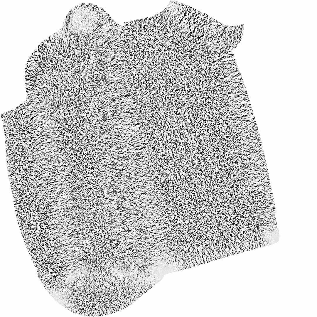 3D sclerotic plaque vessel model https://p.turbosquid.com/ts-thumb/OB/hTv0gm/uLs1kxgu/plaquecave/jpg/1507183666/1920x1080/fit_q87/a806c0d0bf96c057b24a60e16732a0f33cf82ca2/plaquecave.jpg