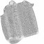 Vessel with Sclerotic Plaque