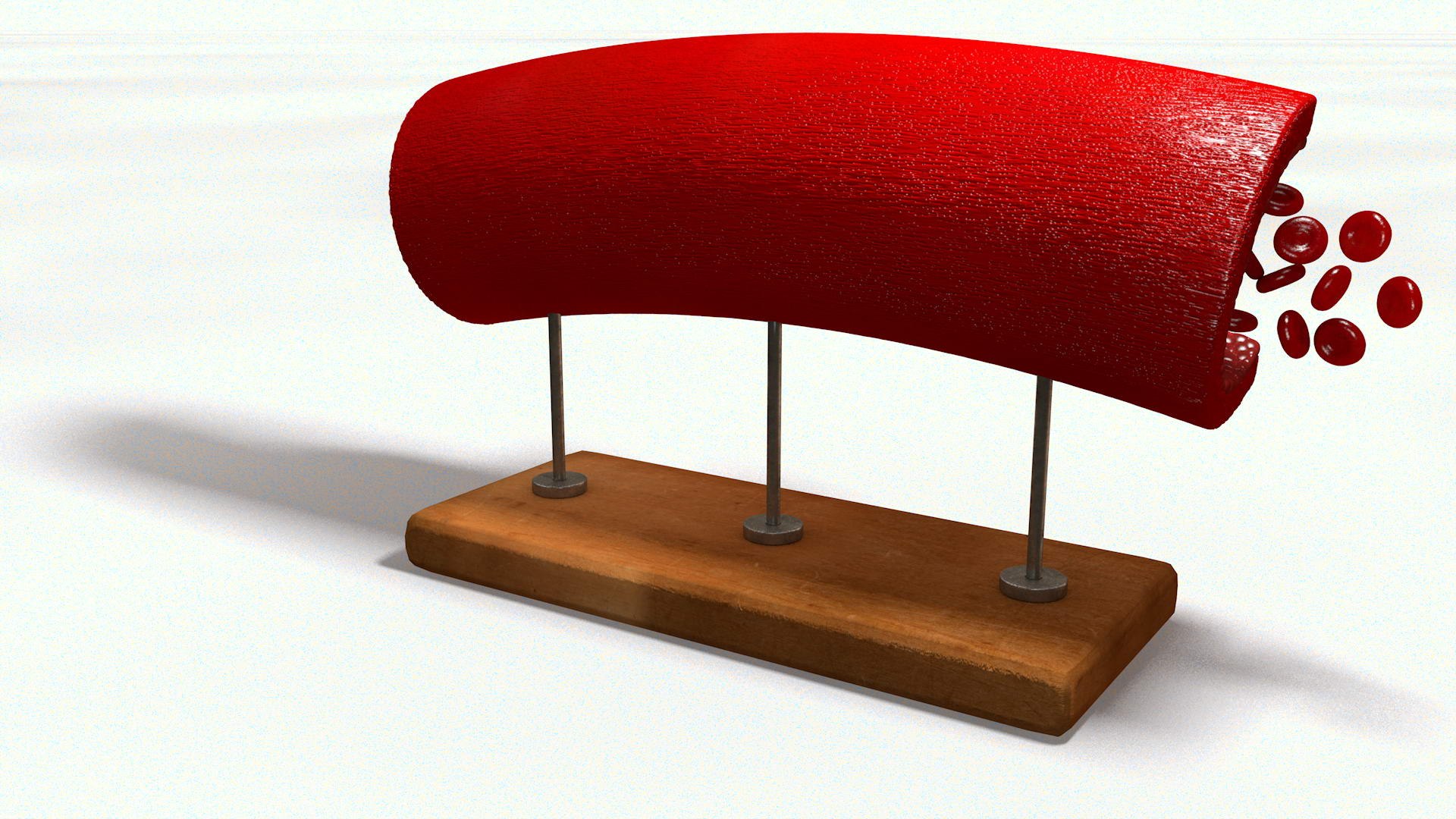 3D sclerotic plaque vessel model https://p.turbosquid.com/ts-thumb/OB/hTv0gm/vswHqG27/sclervesselturn010028/jpg/1507156942/1920x1080/fit_q87/cf66e7767ffd52fd1379315efe0321830b8fe3b2/sclervesselturn010028.jpg