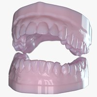 Dentures C Mold