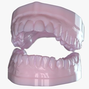 Dentures C Mold