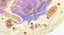 eosinofili