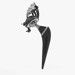 Hip with Pelvic Implant 3D model