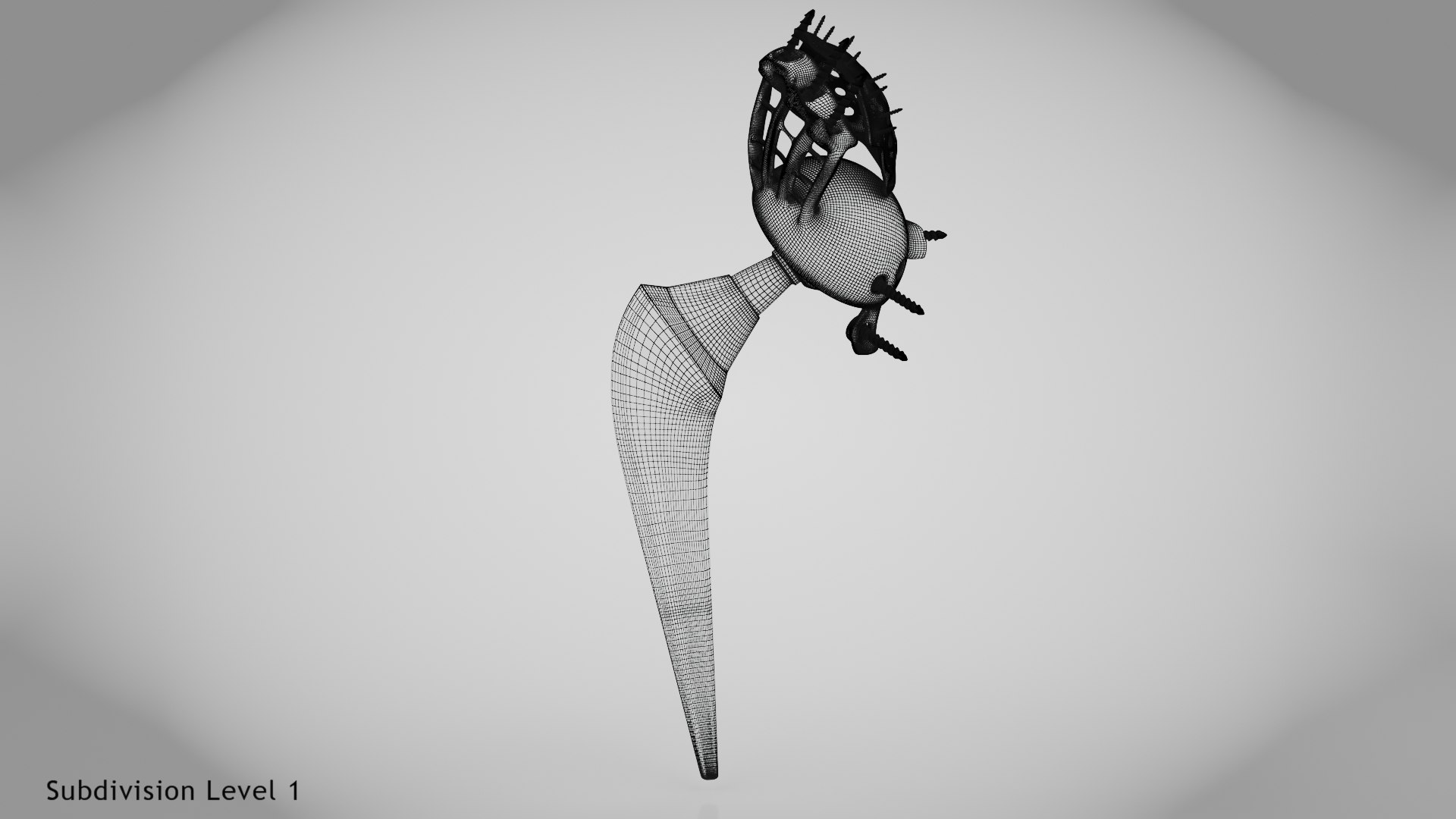 Hip with Pelvic Implant 3D model https://p.turbosquid.com/ts-thumb/OW/j6Hzgd/KO/wire0001copy/jpg/1696264815/1920x1080/fit_q87/91b332679d585c2b0e600f923b1620ef32e5ccac/wire0001copy.jpg