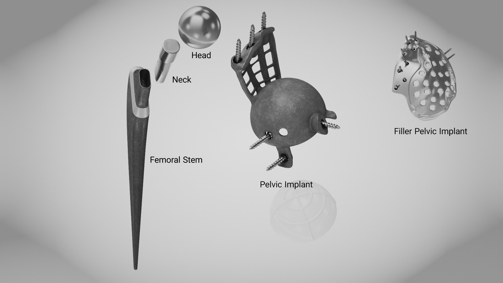 Hip with Pelvic Implant 3D model https://p.turbosquid.com/ts-thumb/OW/j6Hzgd/md/pelvic_implant9/jpg/1696264801/1920x1080/fit_q87/c1c1a768204d8c7e914484bac5a831beabdf5629/pelvic_implant9.jpg