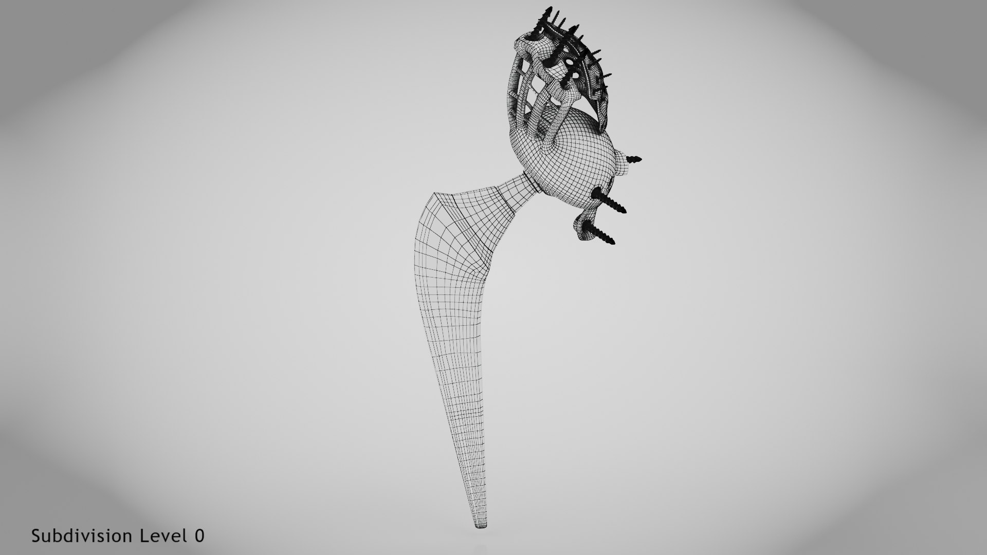Hip with Pelvic Implant 3D model https://p.turbosquid.com/ts-thumb/OW/j6Hzgd/zx/wire0001/jpg/1696264816/1920x1080/fit_q87/59fe41f169302936a02ba9770dced037e9561cd4/wire0001.jpg