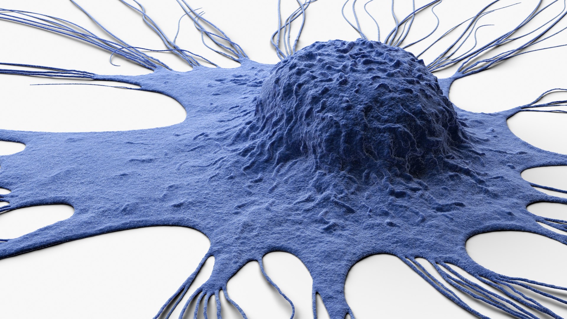 Cancer Cell Breast model https://p.turbosquid.com/ts-thumb/OY/vd5S7C/7G/cu_0000/jpg/1656774497/1920x1080/fit_q87/500e66b7d5c11f8fa82827abdde989790f55266e/cu_0000.jpg